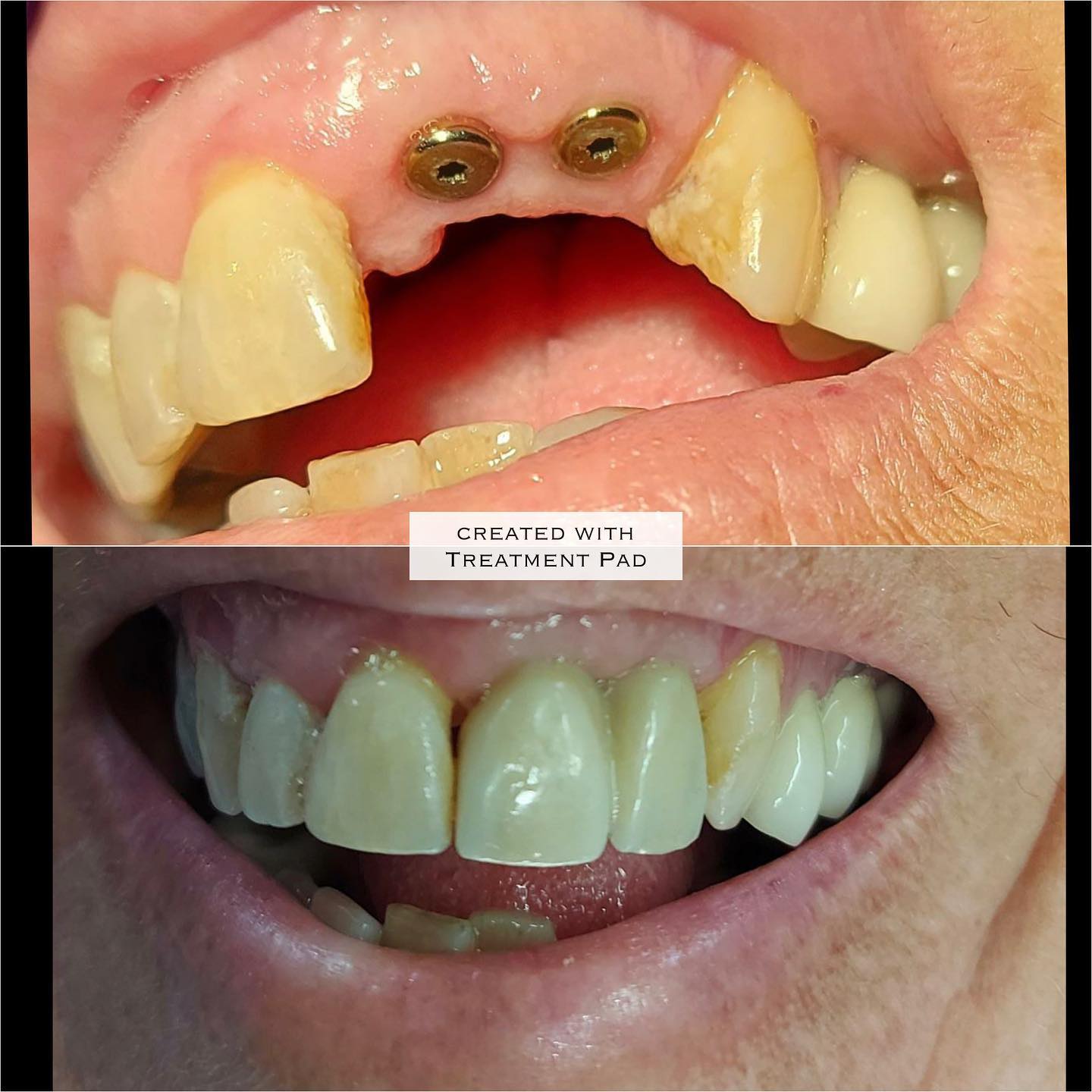 Dental treatment before and after result 3